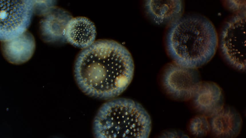 Small reddish microbes float near larger blue and yellow spotted spheres