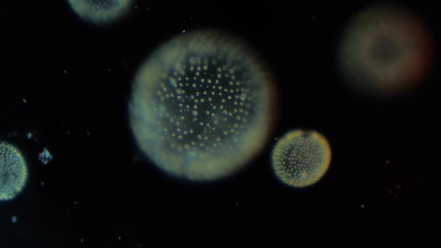 Translucent spotted sphere like cells float through black