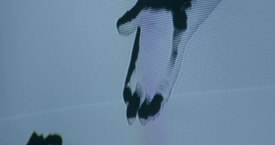 The image on the television is fuzzy