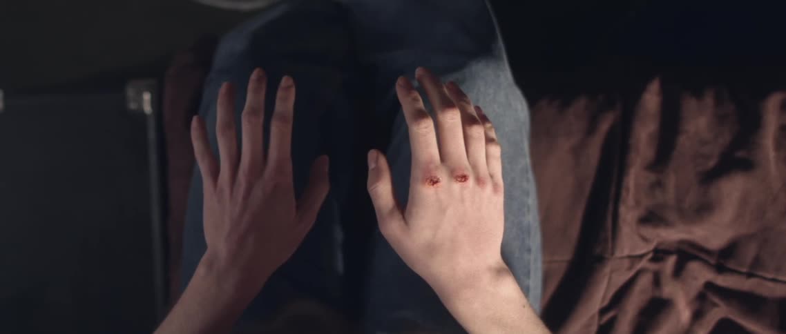 A woman raises her hands with blood on the knuckles