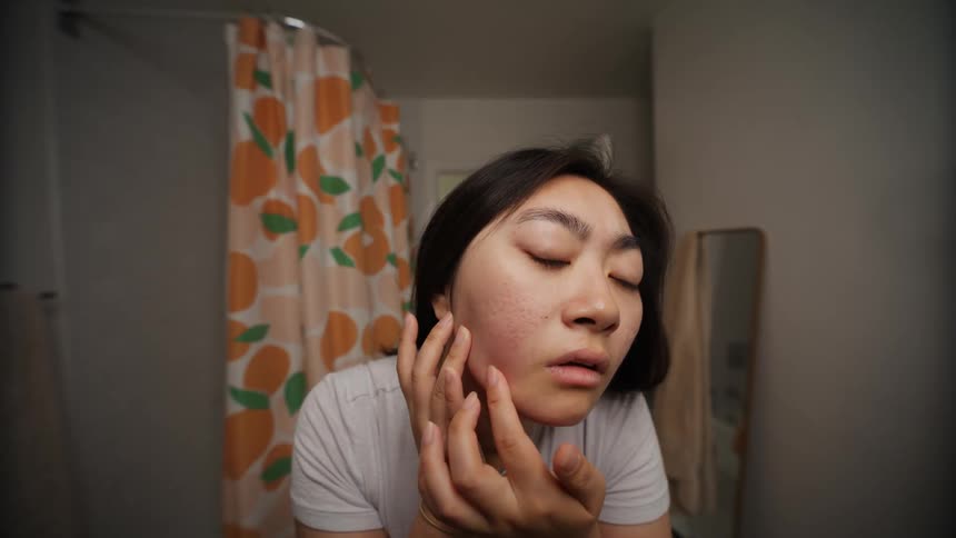 A woman examining her face using her hands to check for pimples and acne