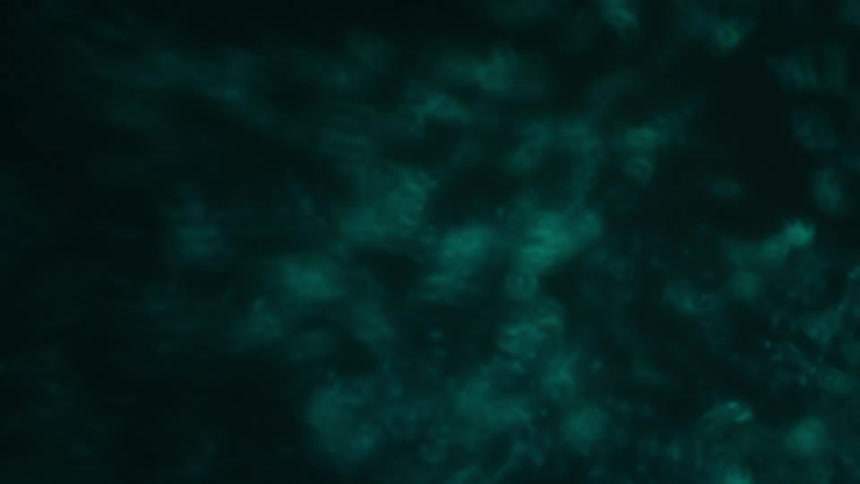 Small bubbles in abstract motion within water against a black background