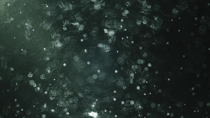 White spots floating on gray medium disappear