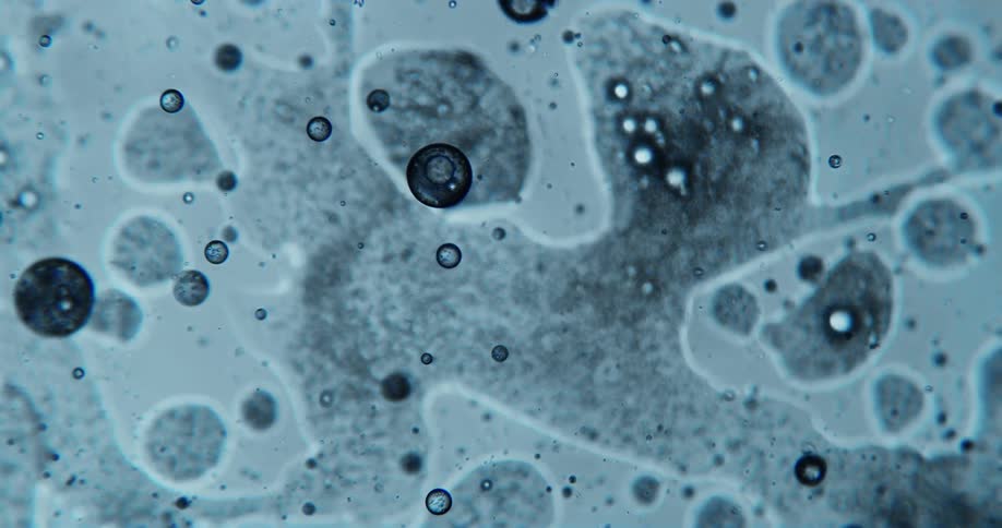 Dense liquid with small bubbles in abstract motion