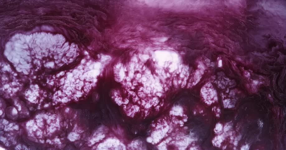 The pink clouds move around