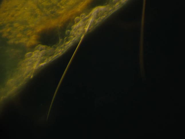 Xray of a green insect swimming in liquid
