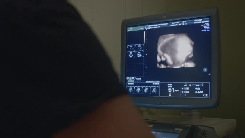 A person is looking at a medical monitor