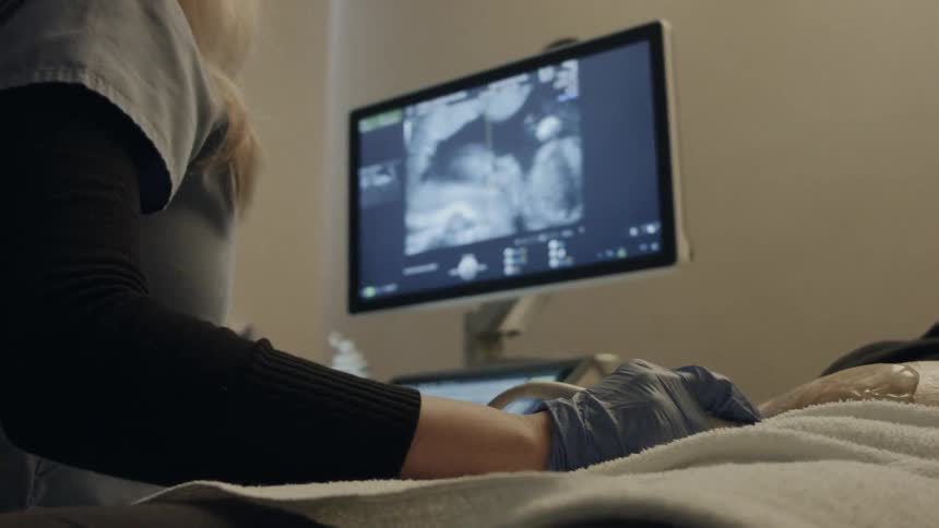 A nurse is performing an ultrasound