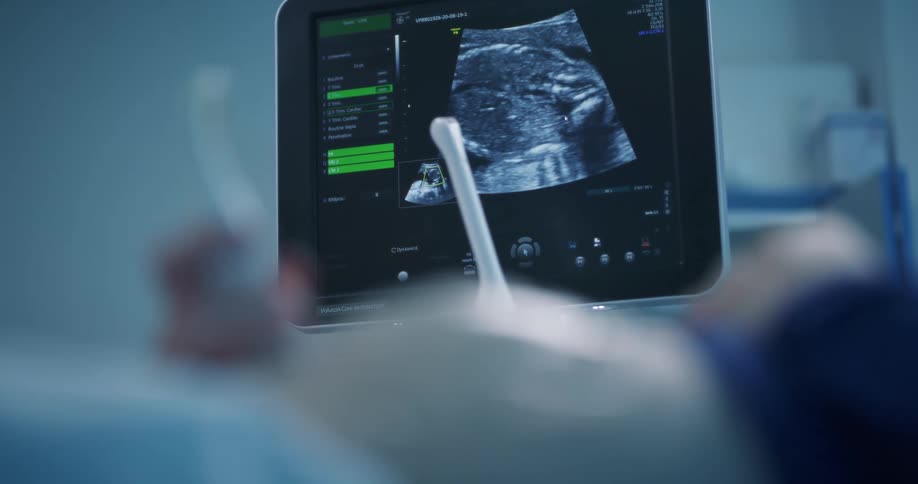 A patient looks at a device showing sonogram results
