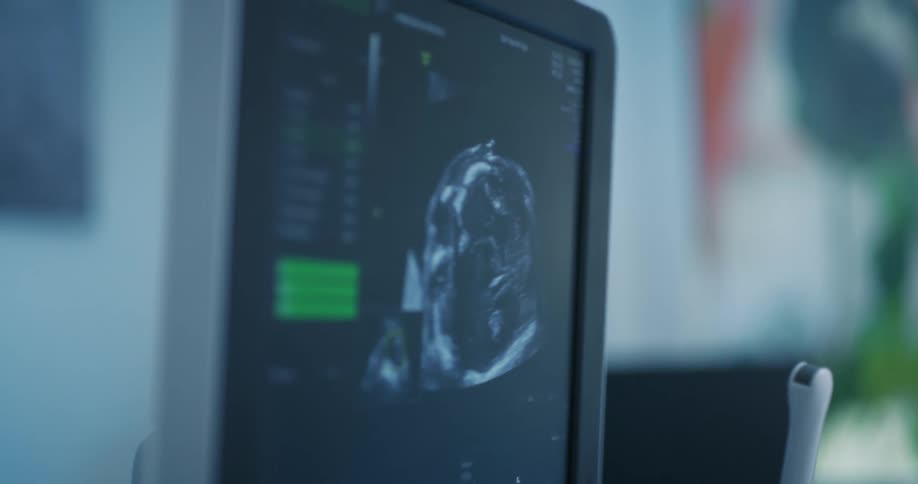 Closeup on a digital screen showing a pregnant womans baby