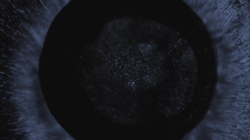 Round black fluid expanding and bright blue pigmentations appearing