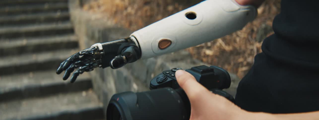 Prosthetic arm and hand reach over to grip camera body