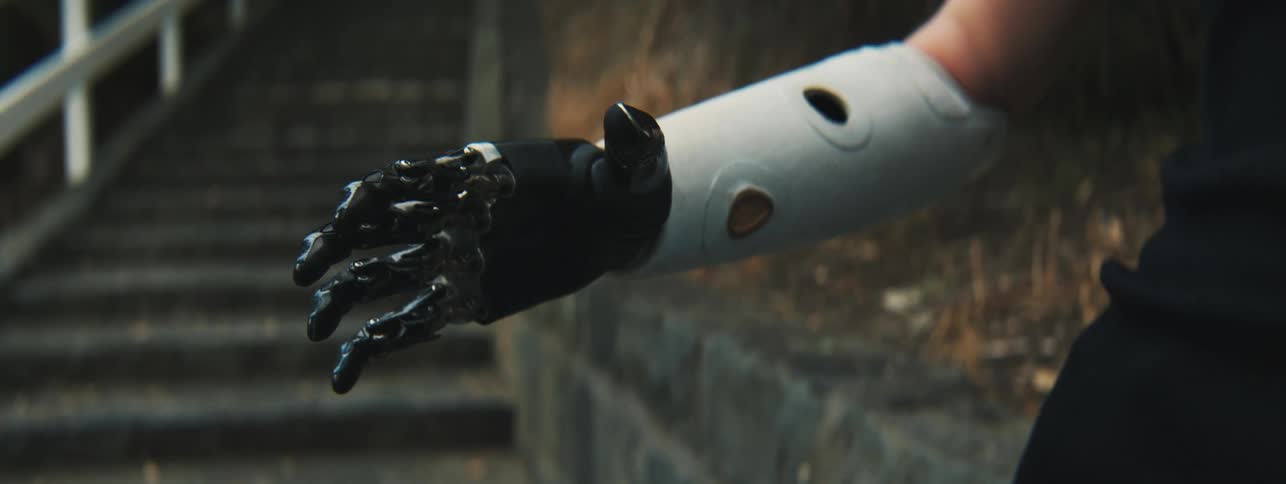 Woman standing near outdoor staircase flexes a prosthetic hand