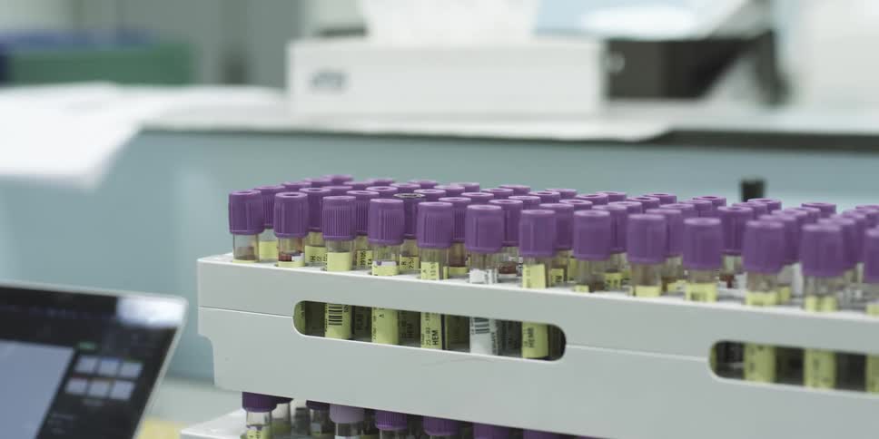 Set of test tubes with purple caps arranged in white holders