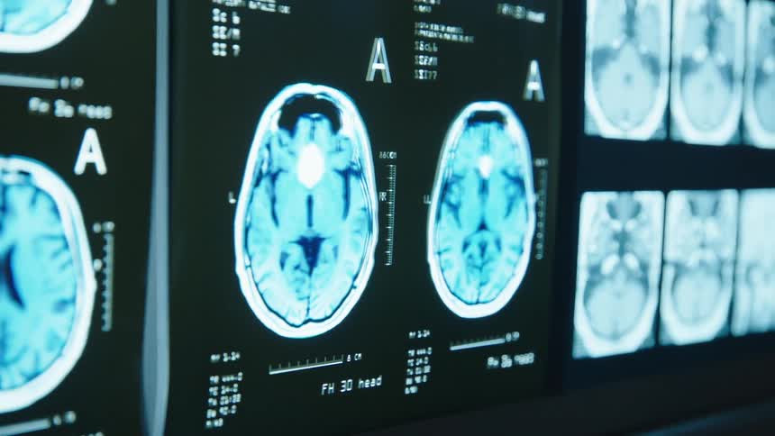 Brain and cranial hanging images are illuminated by machine