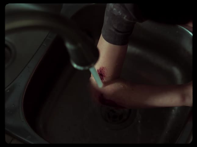 Person washing arm in kitchen sink with injuries