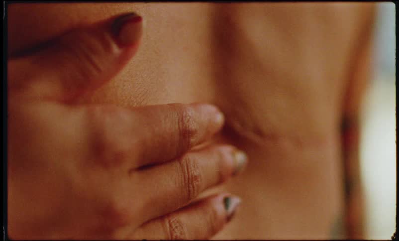 Persons hands run across scar on their chest