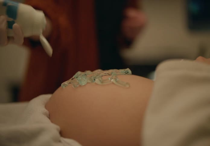 A woman is having an ultrasound