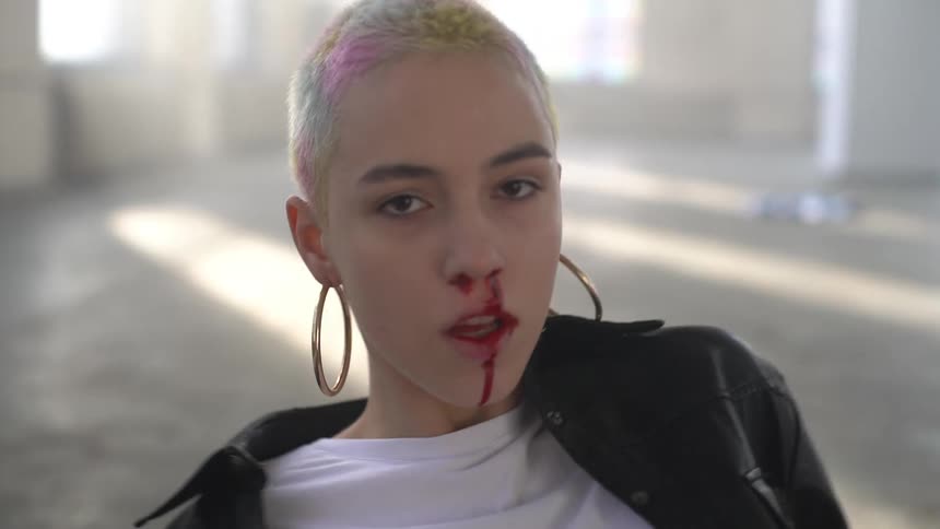 Woman standing up with a bleeding nose