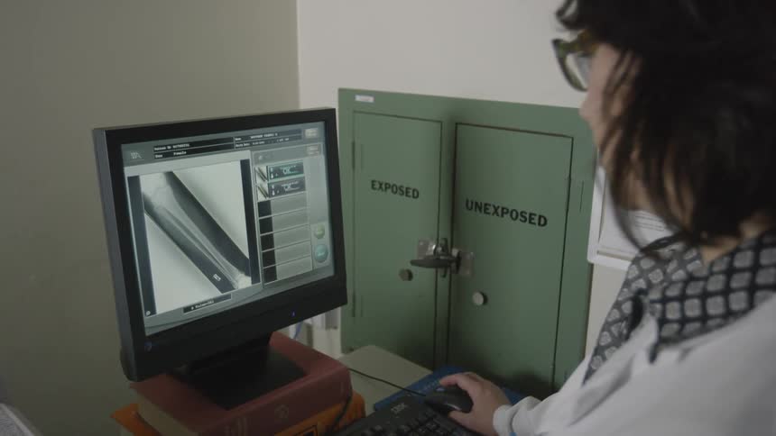 A woman looks at an x-ray displayed on a computer