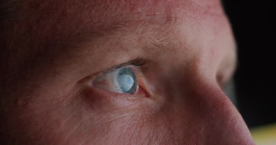 A persons eye with a blue iris reflecting lights in front of it and the eye is moving sideways