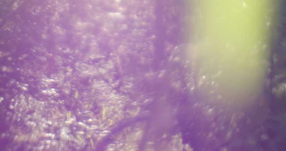 Heavy sunlight glares on the forest