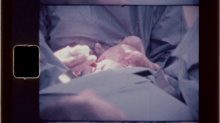 Newly born baby pulled out by doctors