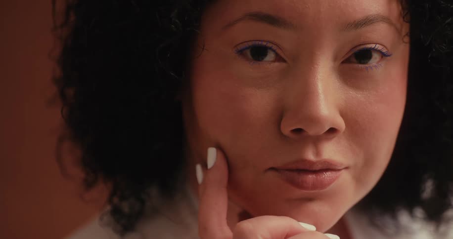 A close up of a woman with vitiligo puts her hand on her chin