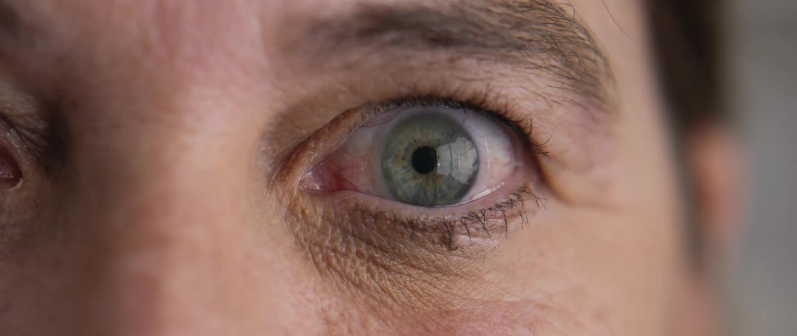 Closeup of a persons green eye as the iris contracts during opening