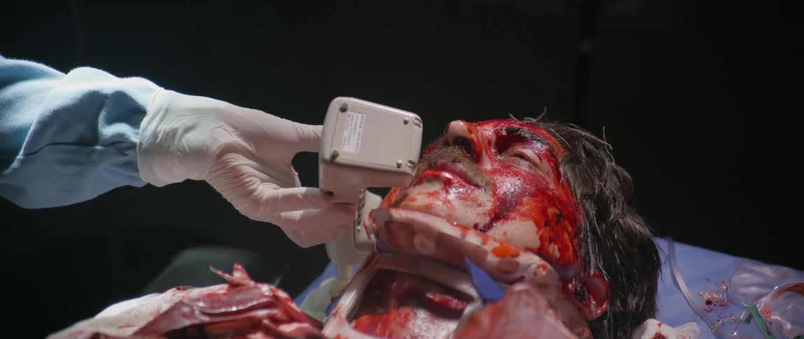 A doctor gives a man covered in blood the phone in the operating room