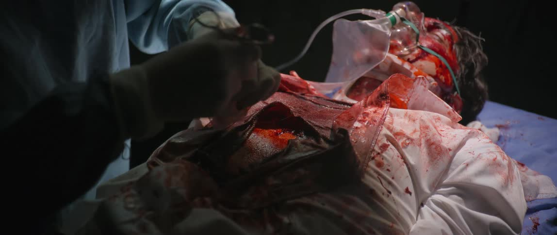 A doctor cuts a bleeding mans shirt off in the operating room
