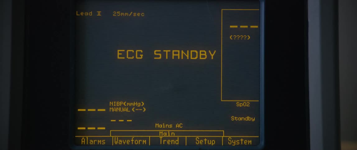 The monitor in the hospital displays information
