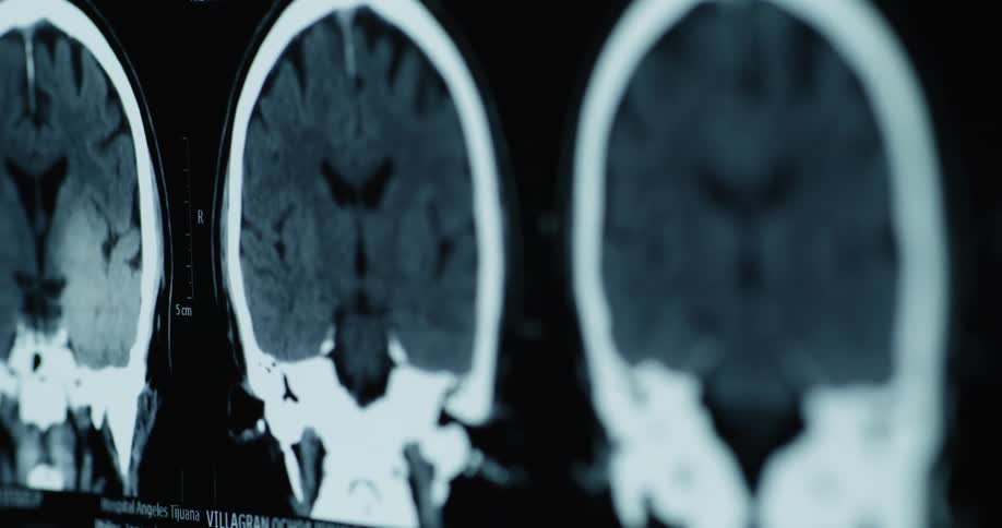 Close up visual of various brain ct scan images