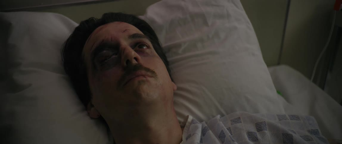 The face of a man who is all bruised lying in a hospital bed and he starts crying