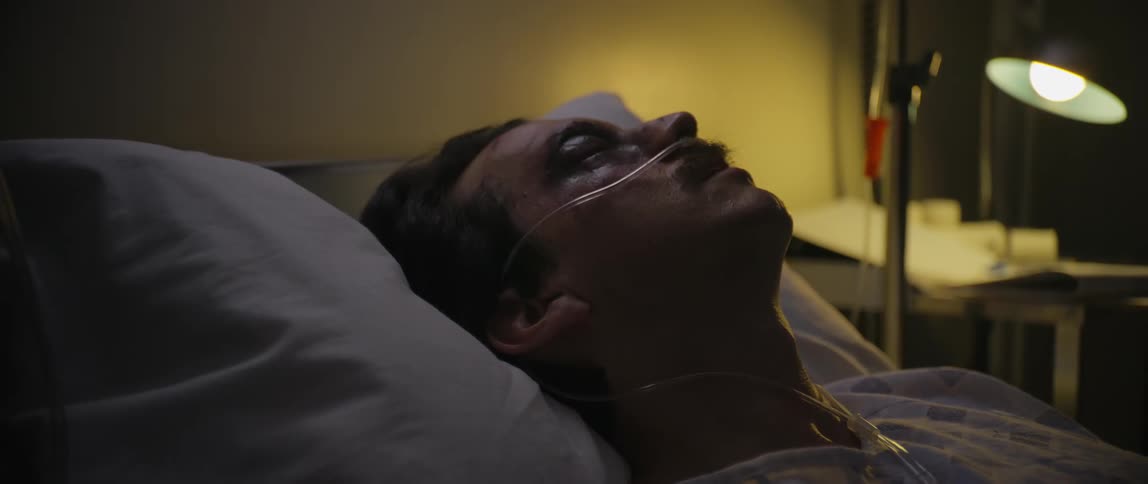 The face of a man who is injured with an oxygen tube in his body he is lying down sleeping