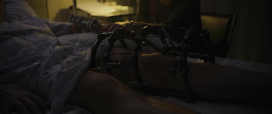 Patient lying in a hospital bed has his leg immobilized with a metal external fixator