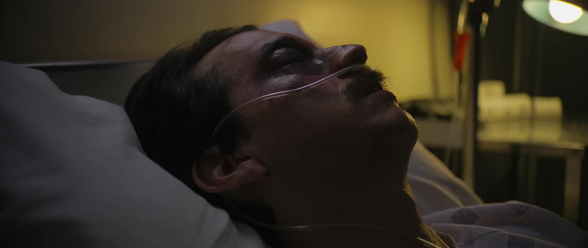 An injured man is sleeping in the hospital