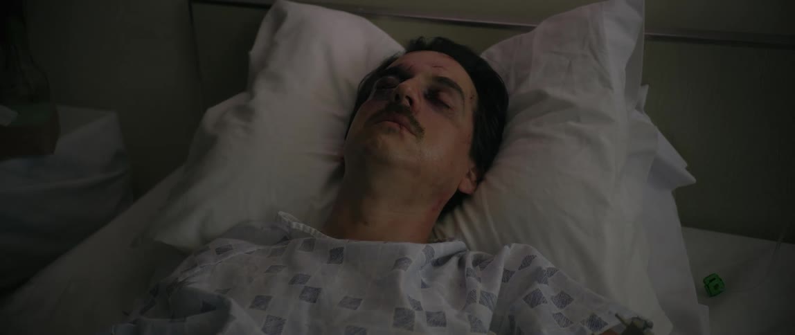 A man lies in a dimly lit hospital bed his face marked with bruises and scars as he rests