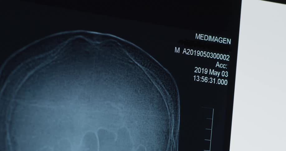 Medical x ray displays patient information