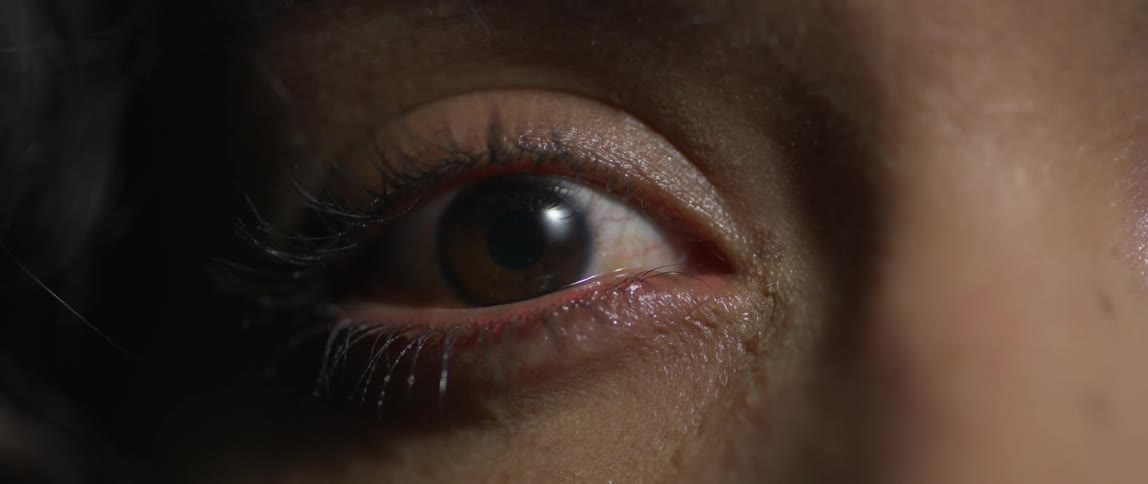 A wideopen eye stares ahead conveying shock with sharp detail on lashes and skin texture