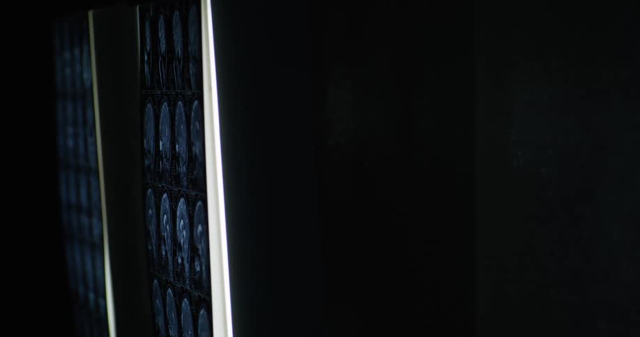 Several illuminated medical scan images are mounted on a dark surface