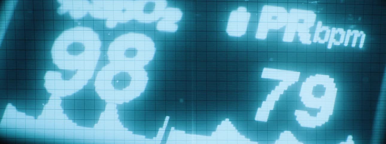 A cyantoned medical monitor displays spo2 and pr bpm indicators along with a fluctuating waveform and horizontal dashed lines on a dark gridded screen