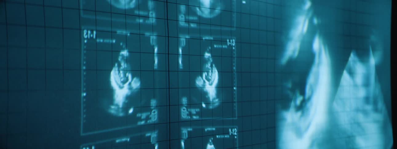 A blue screen has several different white images that resemble a beating heart