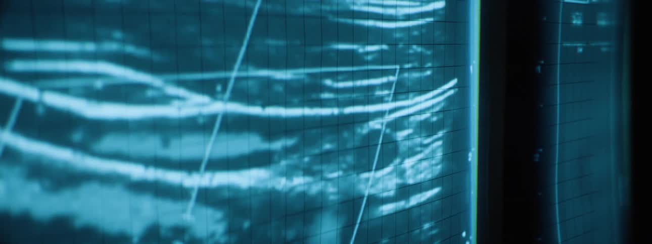 Ultrasound with longitudinal sections with lines and technical data