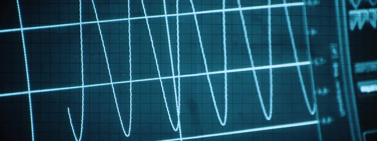 A heart rate monitor device displaying a series of fluctuating lines indicating the heartbeat rhythm in realtime