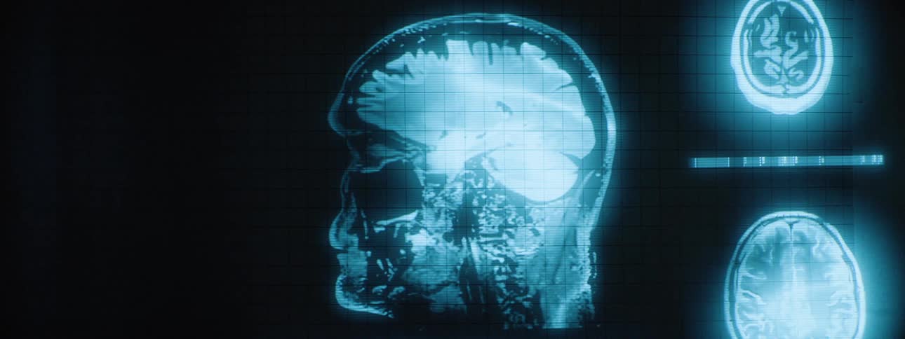 A persons ct scan