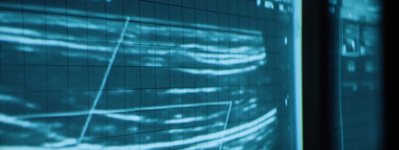 A monitor displaying ultrasound images