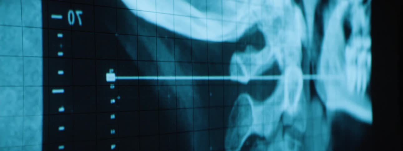 A medical image of a skull and spine is displayed on a monitor