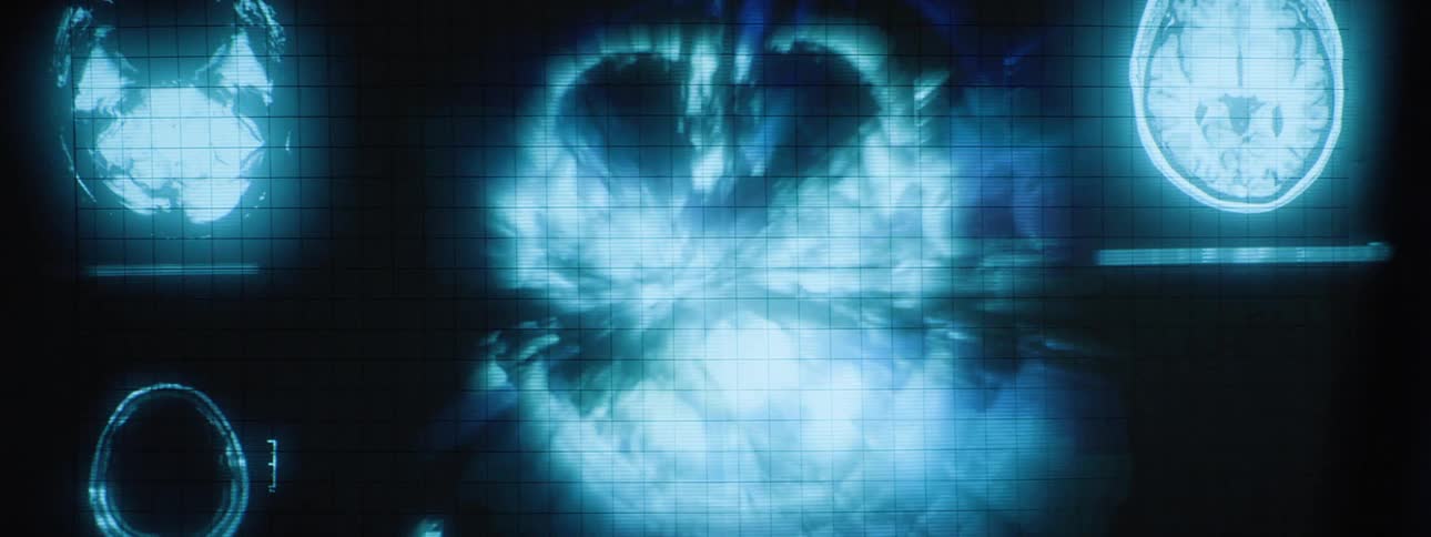 A ct scan of a persons head are flashing on the wall