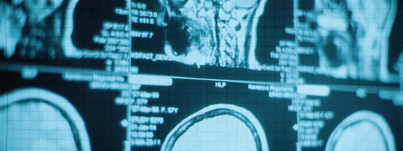 Ct imaging scans of a brain on a monitor screen